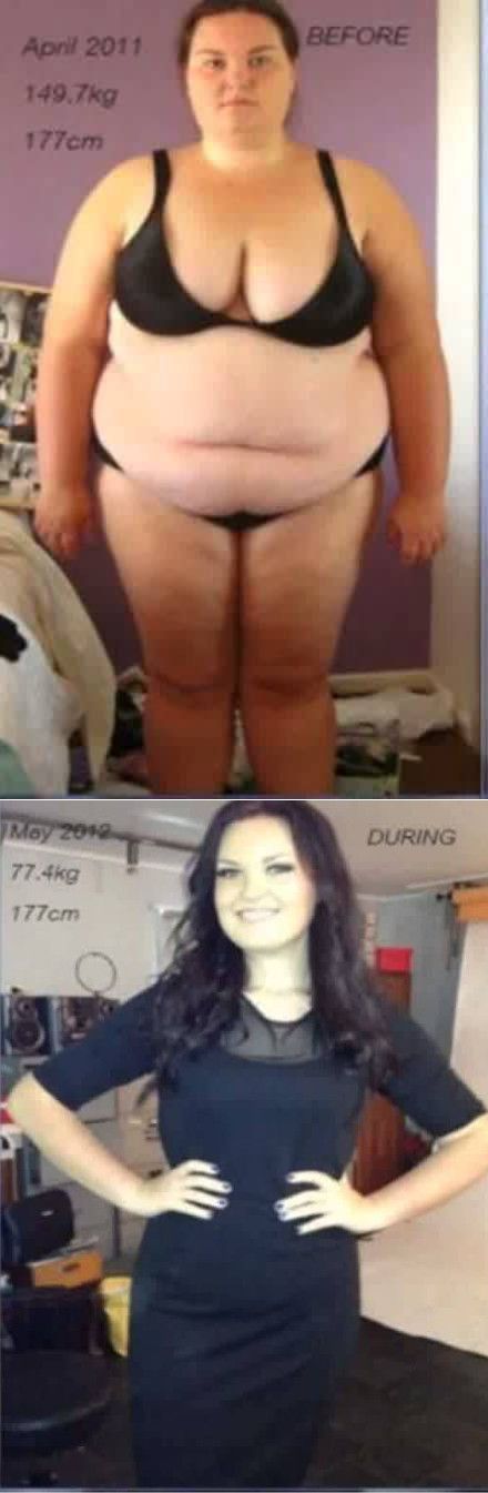 Transformation avant après régime d'une femme qui a perdue 72 kilos