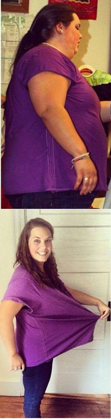 Transformation avant après de Mary maxwell qui a perdu 75 kilos de graisses