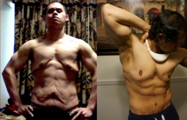 Jon Calvo après avoir perdu 90 kilos puis après son opération de retrait d'excès de peau